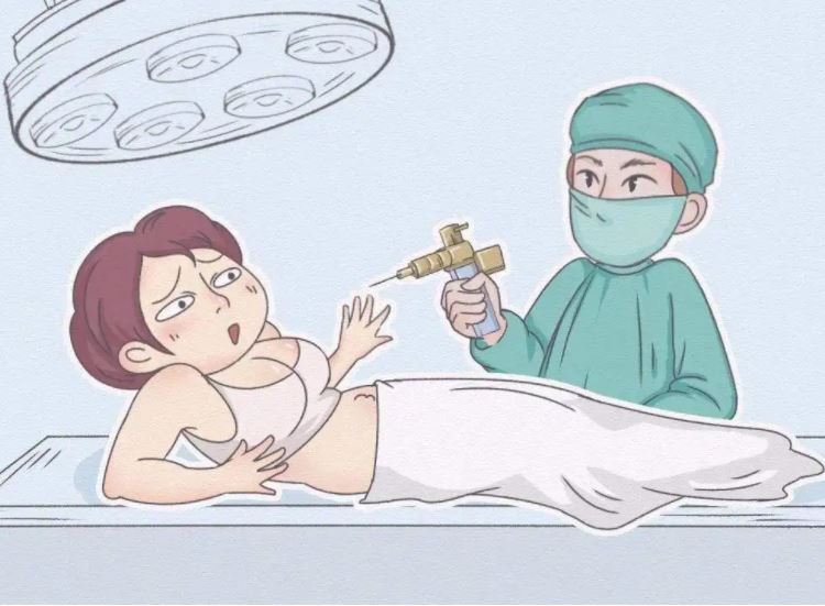 全身抽脂對身體有什么傷害？